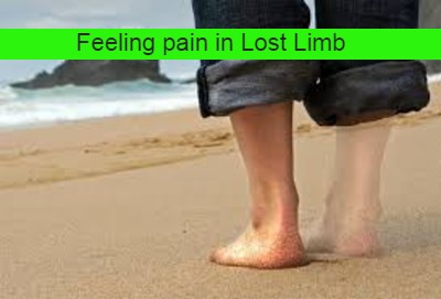 the-lost-limb-is-still-aching-its-a-phantom-pain